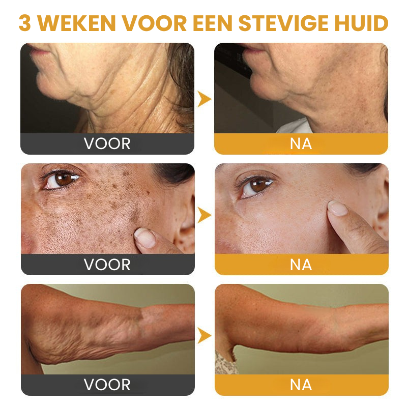 Vordela™ | Botox Rimpelverstevigende Crème