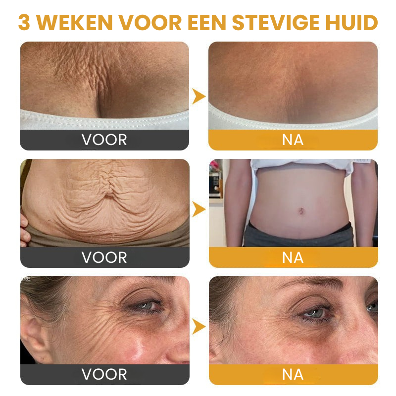 Vordela™ | Botox Rimpelverstevigende Crème