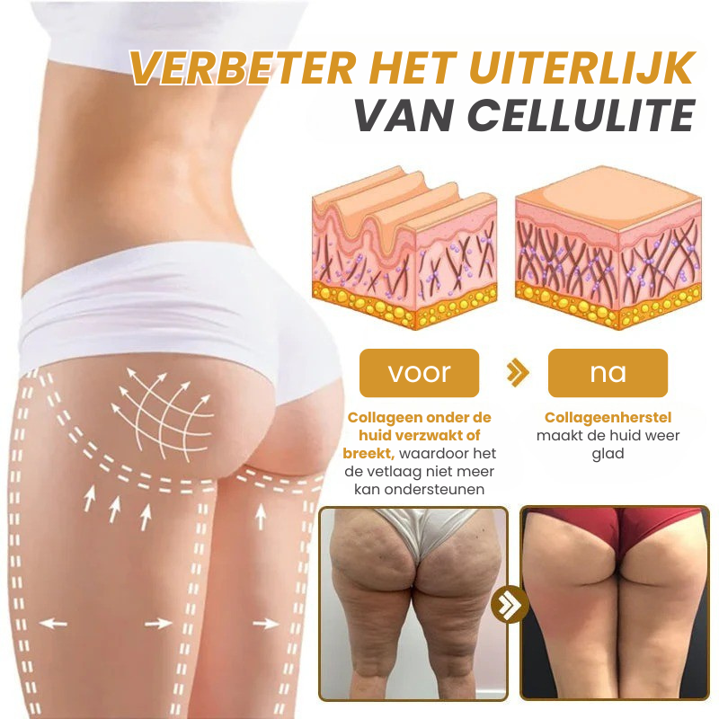 Vordela™ | Botox Rimpelverstevigende Crème