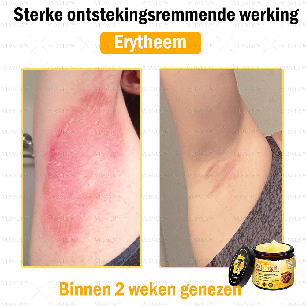 Vordela™ Bijengif Huidherstellende Crème