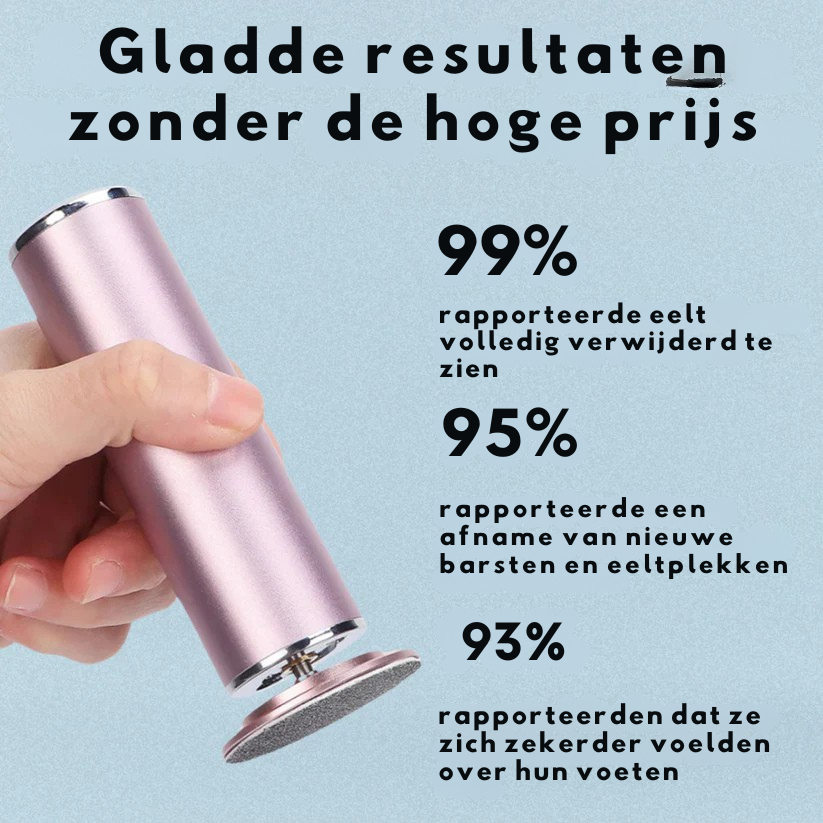 Vordela™ Elektrische eeltverwijderaar voor voeten