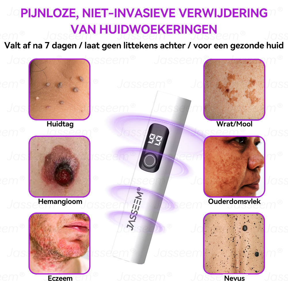 Vordela- Geavanceerde Niet-Invasieve Huidherstel CO₂-Laserpen