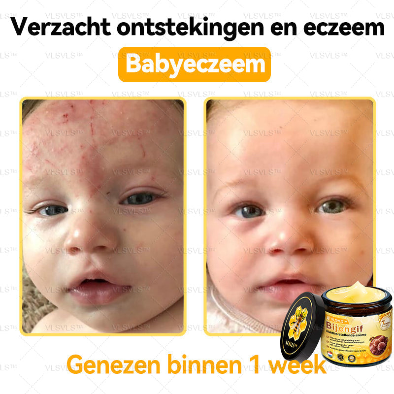 Vordela™ Bijengif Huidherstellende Crème