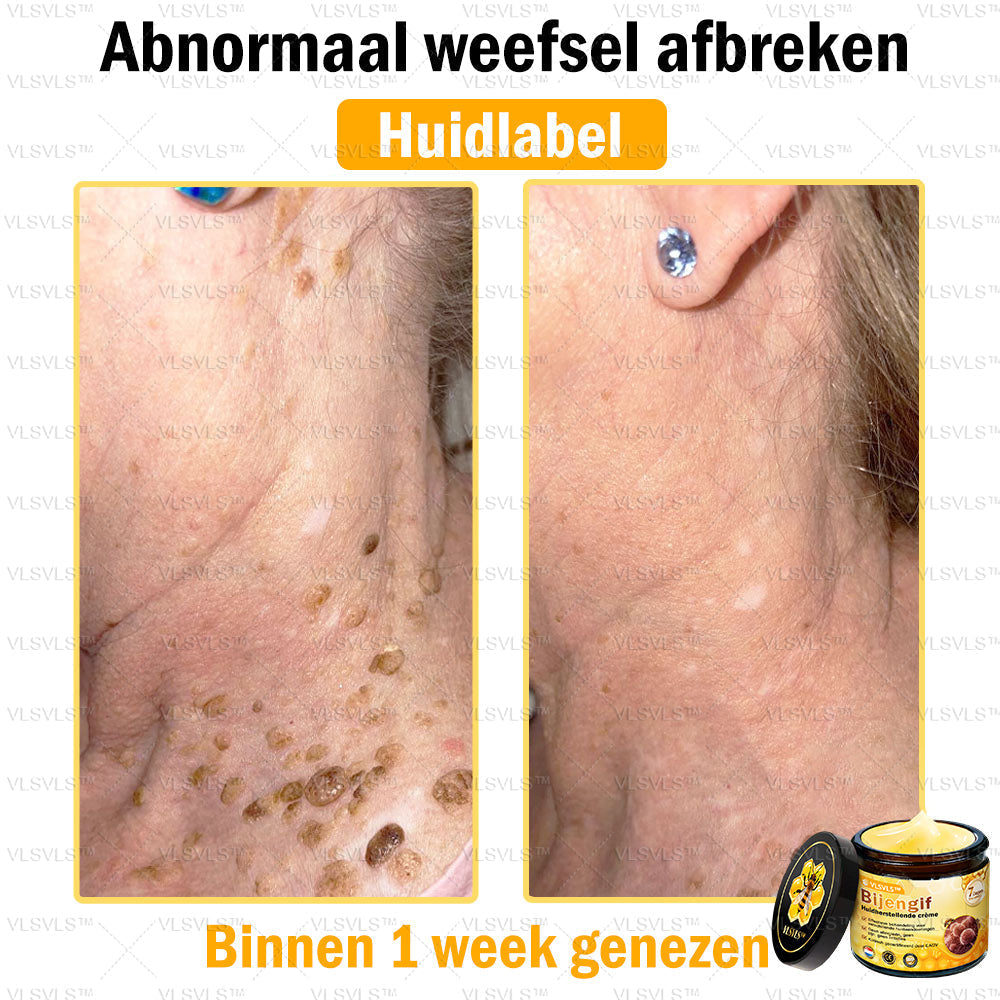 Vordela™ Bijengif Huidherstellende Crème