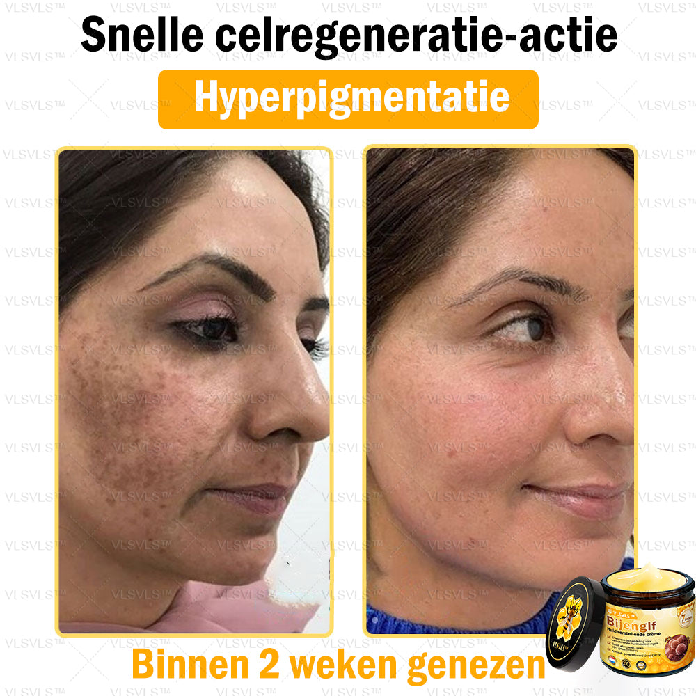 Vordela™ Bijengif Huidherstellende Crème
