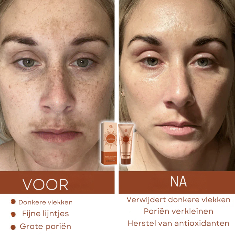 Vordela™ Kruidenvlekken Peel-Off Gezichtsmasker
