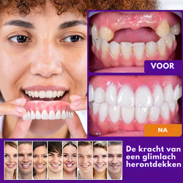 Vordelaยฎ Set van siliconen kunstgebitten nu 50% korting