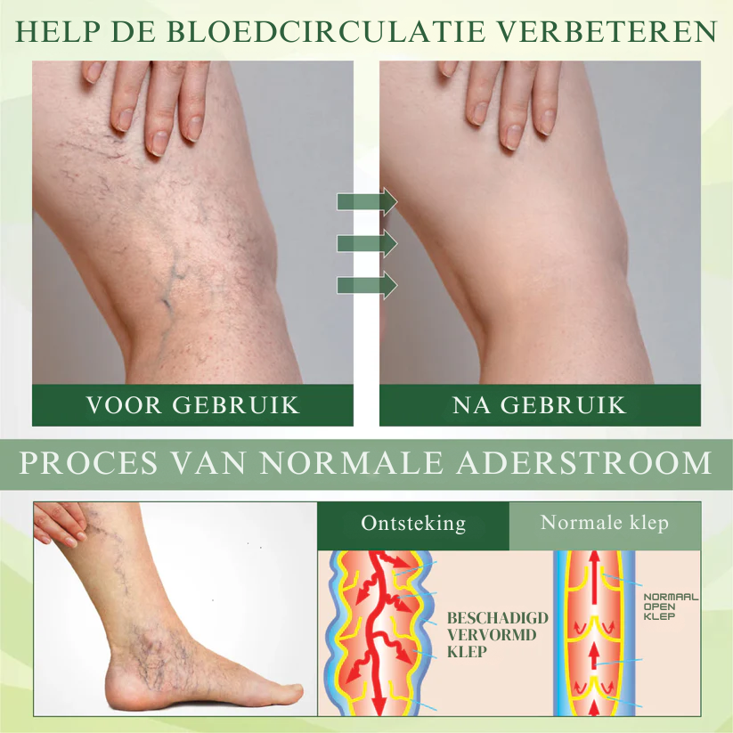 Vordela® EdemaFree Flow Drain Massage Cream