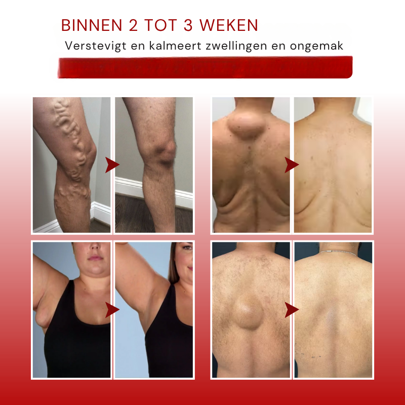 Vordela¨ SwellCare Geavanceerde Lymfedrainage Massagecrème