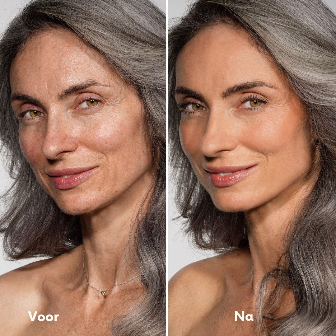 Vordela¨ Changing Foundation