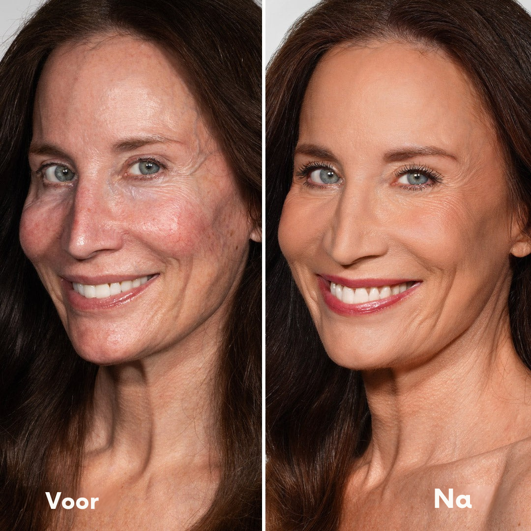 Vordela¨ Changing Foundation