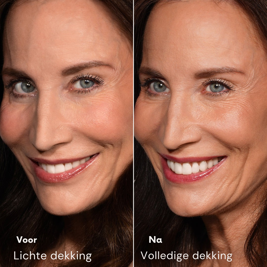 Vordela¨ Changing Foundation