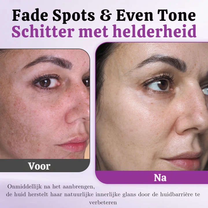 Vordela® MelantraX Advanced Anti-Hyperpigmentatie Essentie
