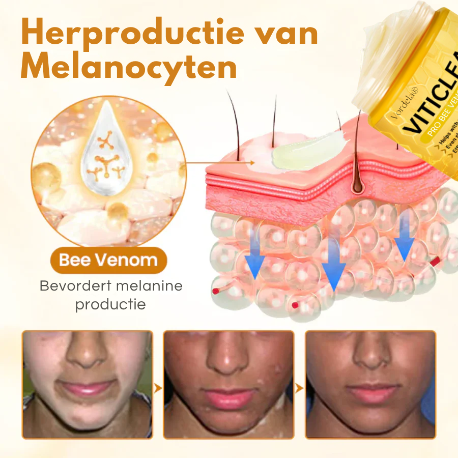 Vordela® VitiClear Pro Bijengif crème
