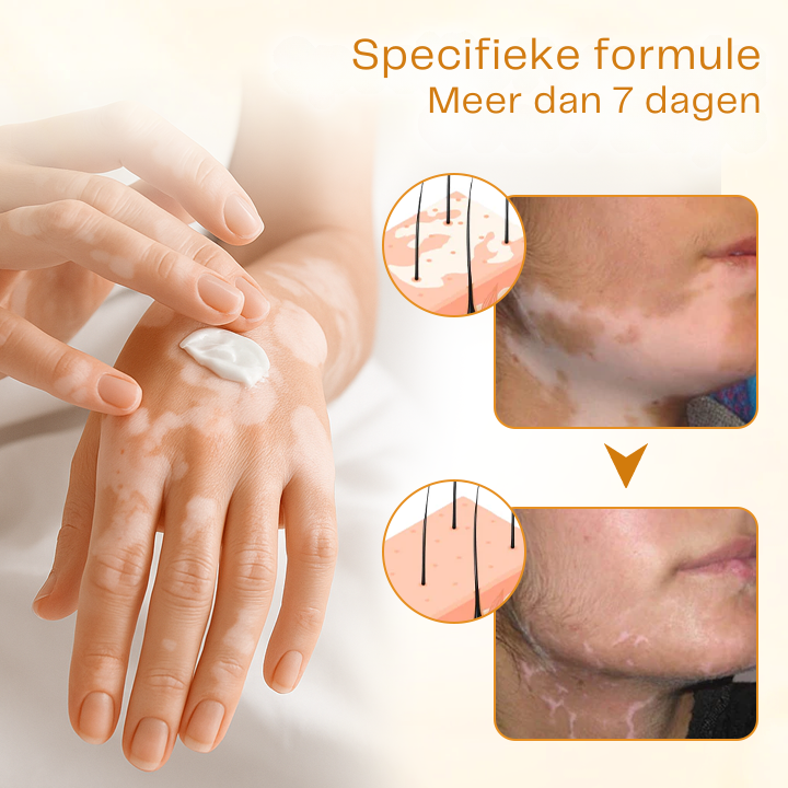Vordela® VitiClear Pro Bijengif crème