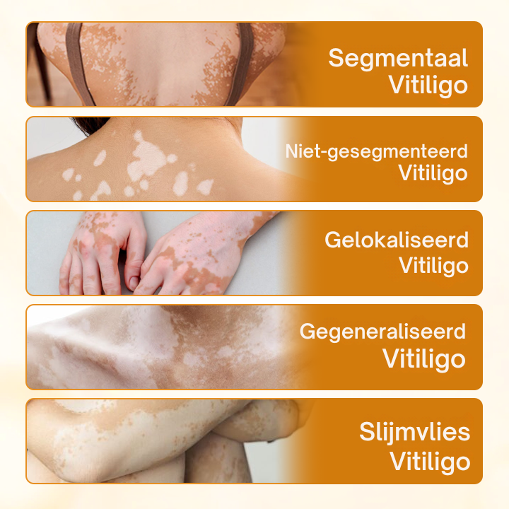Vordela® VitiClear Pro Bijengif crème