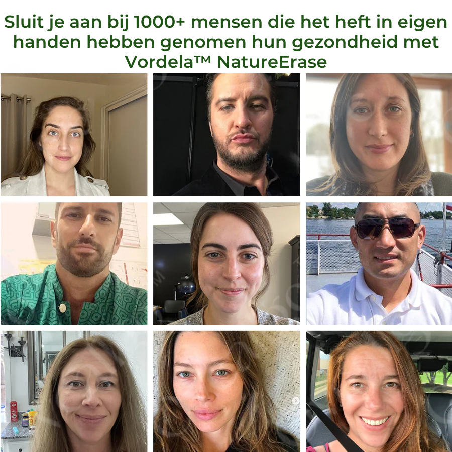 Vordela™ NatureErase Instant Mollen- en Vlekcrème