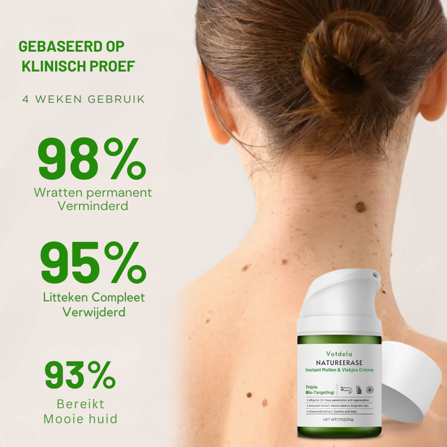 Vordela™ NatureErase Instant Mollen- en Vlekcrème