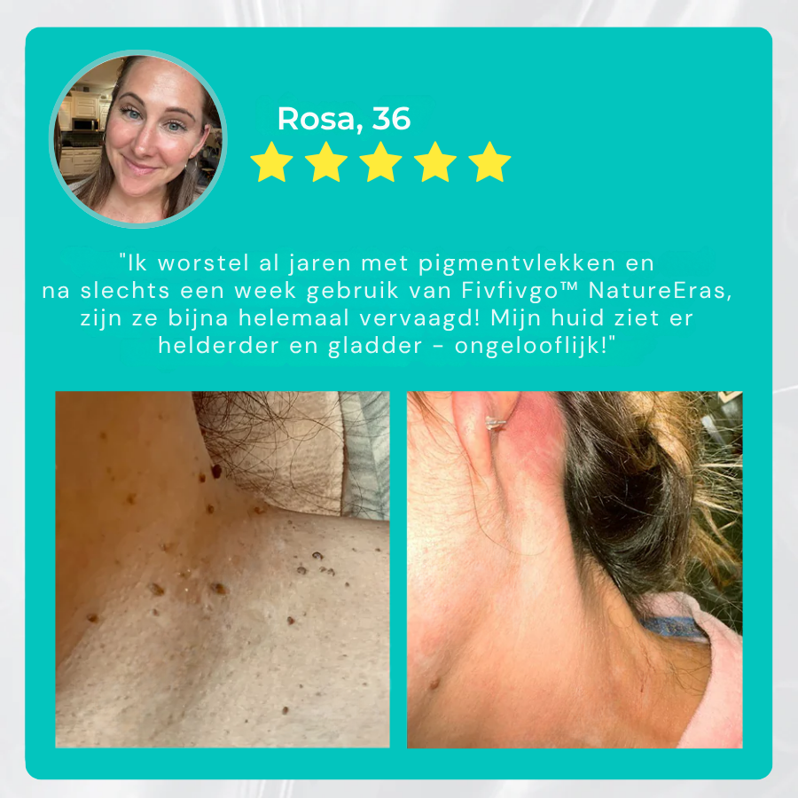 Vordela™ NatureErase Instant Mollen- en Vlekcrème