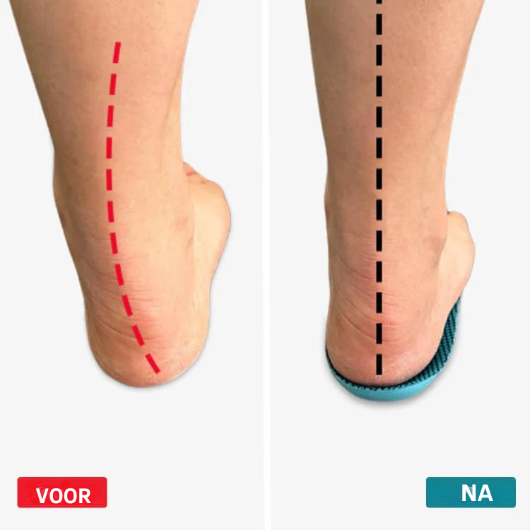 Vordela™ ComfySole inlegzolen - lopen zonder pijn