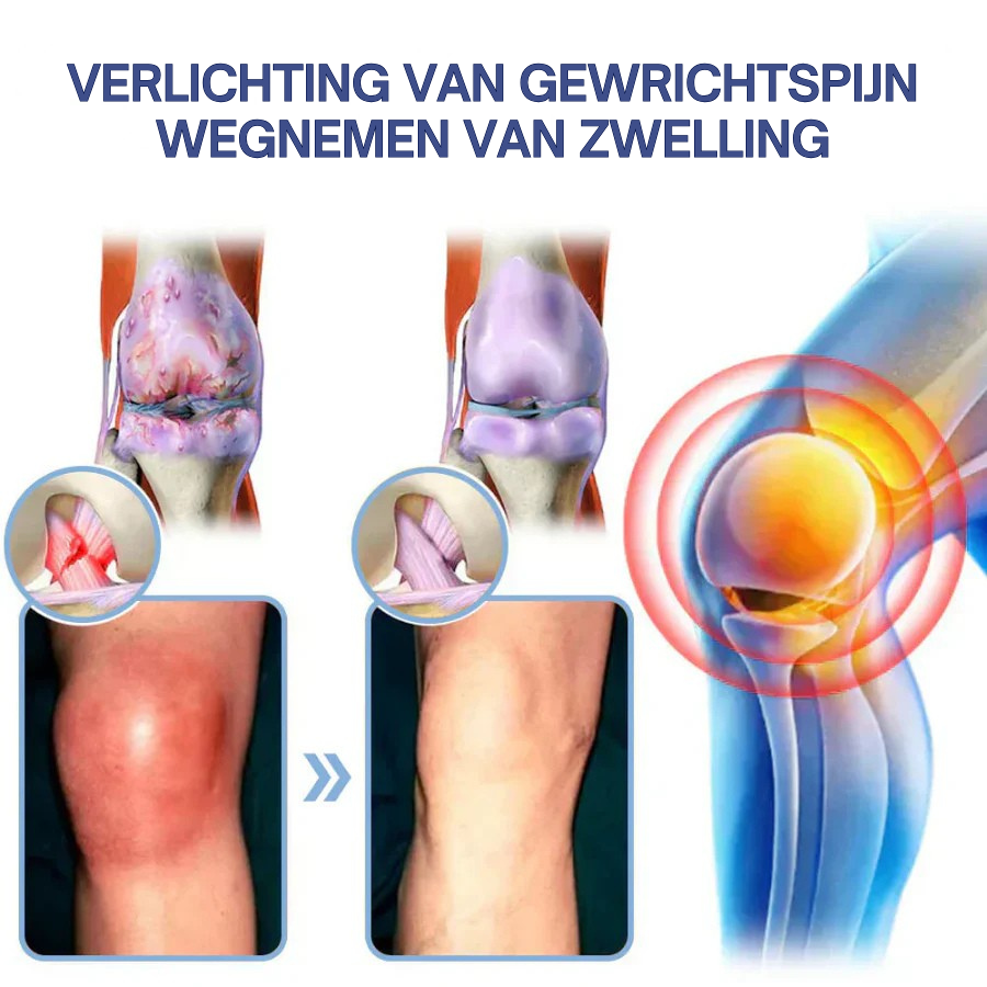 Vordela® Geavanceerde magnesium pijnstillende crème