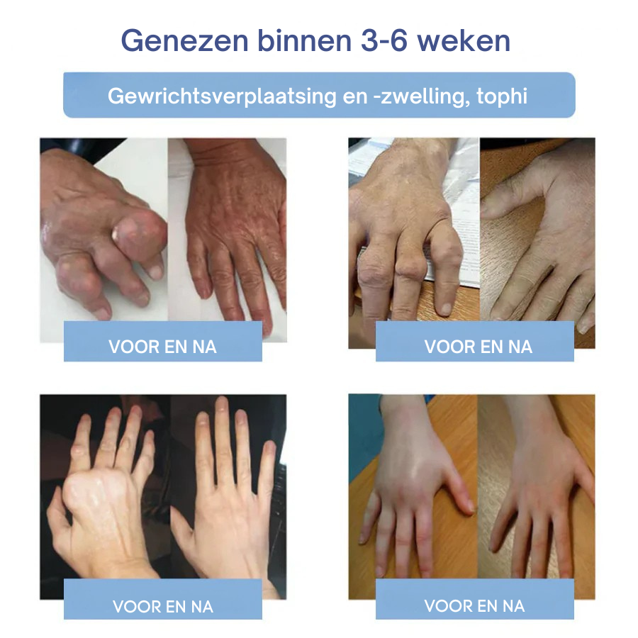 Vordela® Geavanceerde magnesium pijnstillende crème