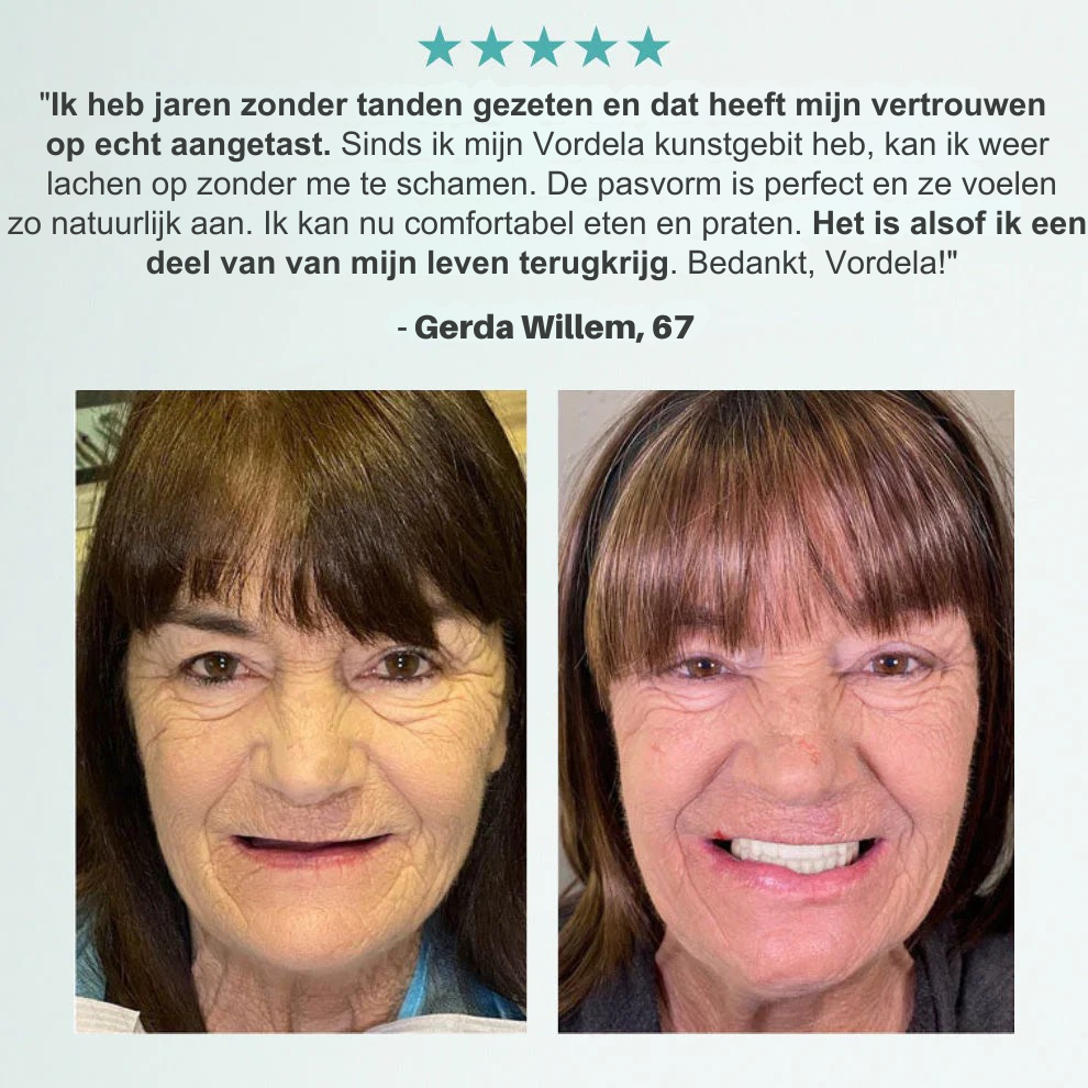 Vordela® Op maat gemaakte volledig functionele prothesen maken u zelfverzekerder
