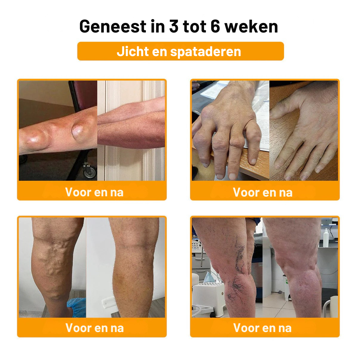 Gemaakt✨ en verzonden vanuit Nederland | ✅ Officiële winkel Vordela® Bijengif Pijnverlichtende Crème 🐝 🔥 Speciaal voor ouderen & aanbevolen door orthopeden