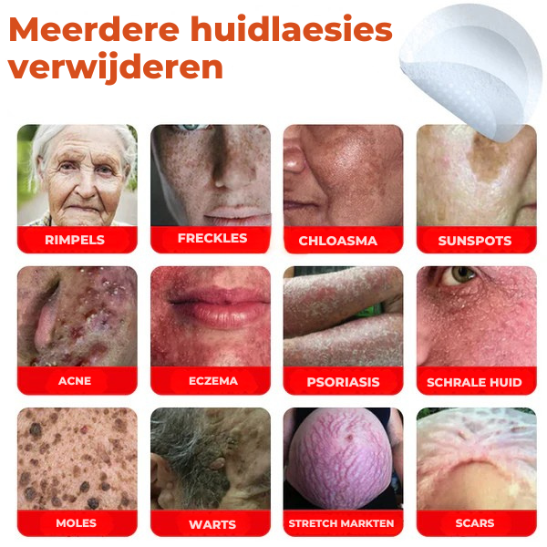 Vordela® MicroNaald Botanisch Huidtag verwijderen patch