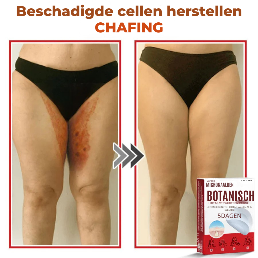 Vordela® MicroNaald Botanisch Huidtag verwijderen patch