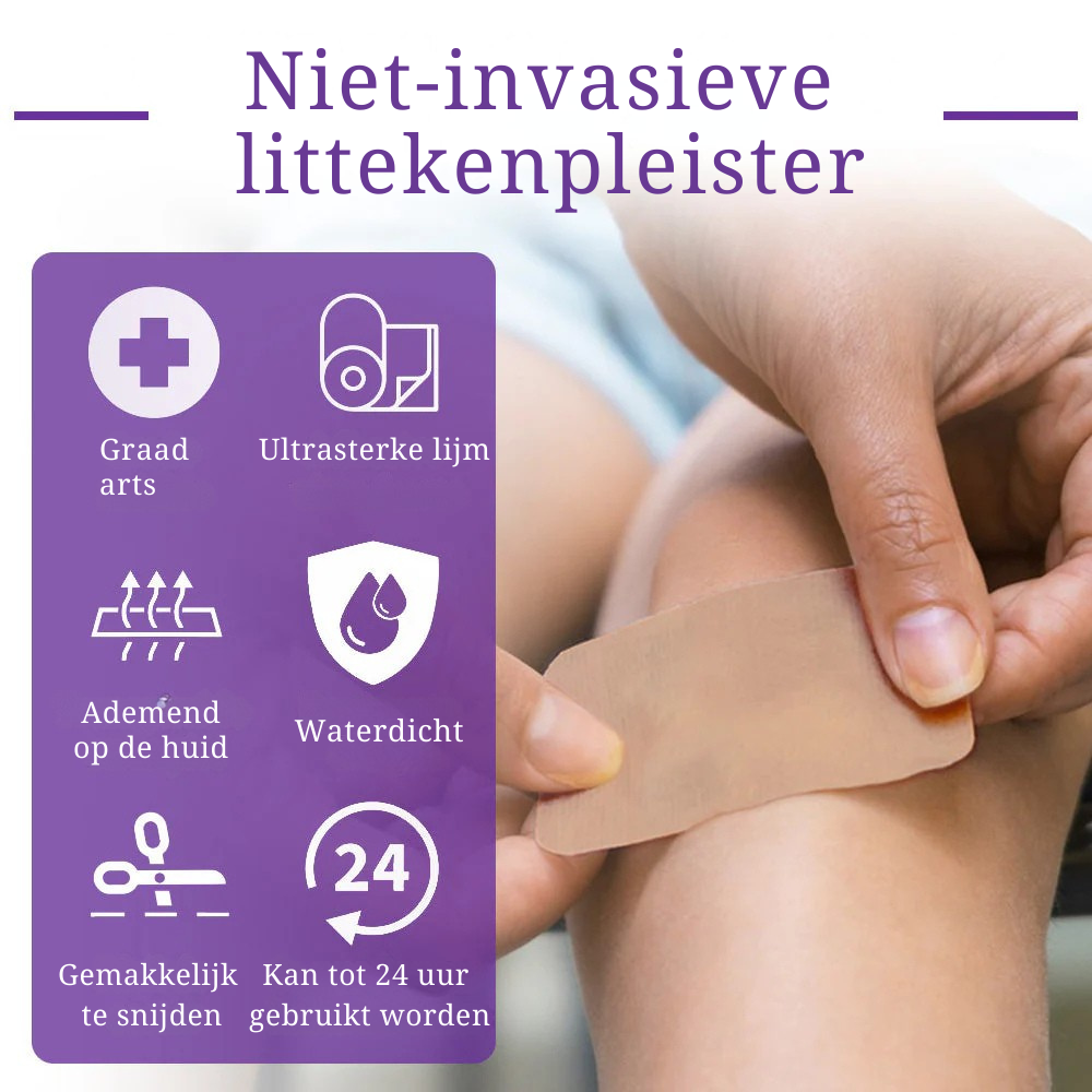 Vordela® 🏷️ ReGen Micronaald Tape met Nano-Hyaluronzuur 💊 Voor behandeling van littekens, striae, keloïden, acne, brandwonden en huidoneffenheden