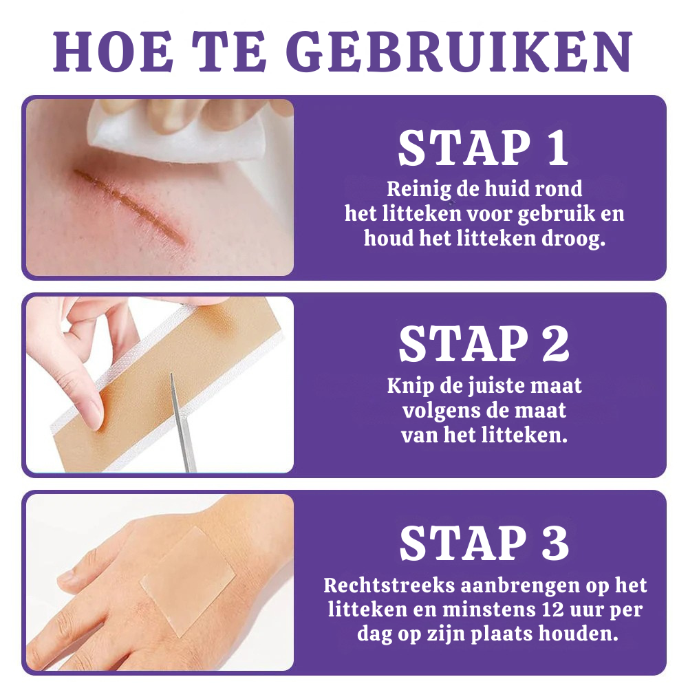 Vordela® 🏷️ ReGen Micronaald Tape met Nano-Hyaluronzuur 💊 Voor behandeling van littekens, striae, keloïden, acne, brandwonden en huidoneffenheden