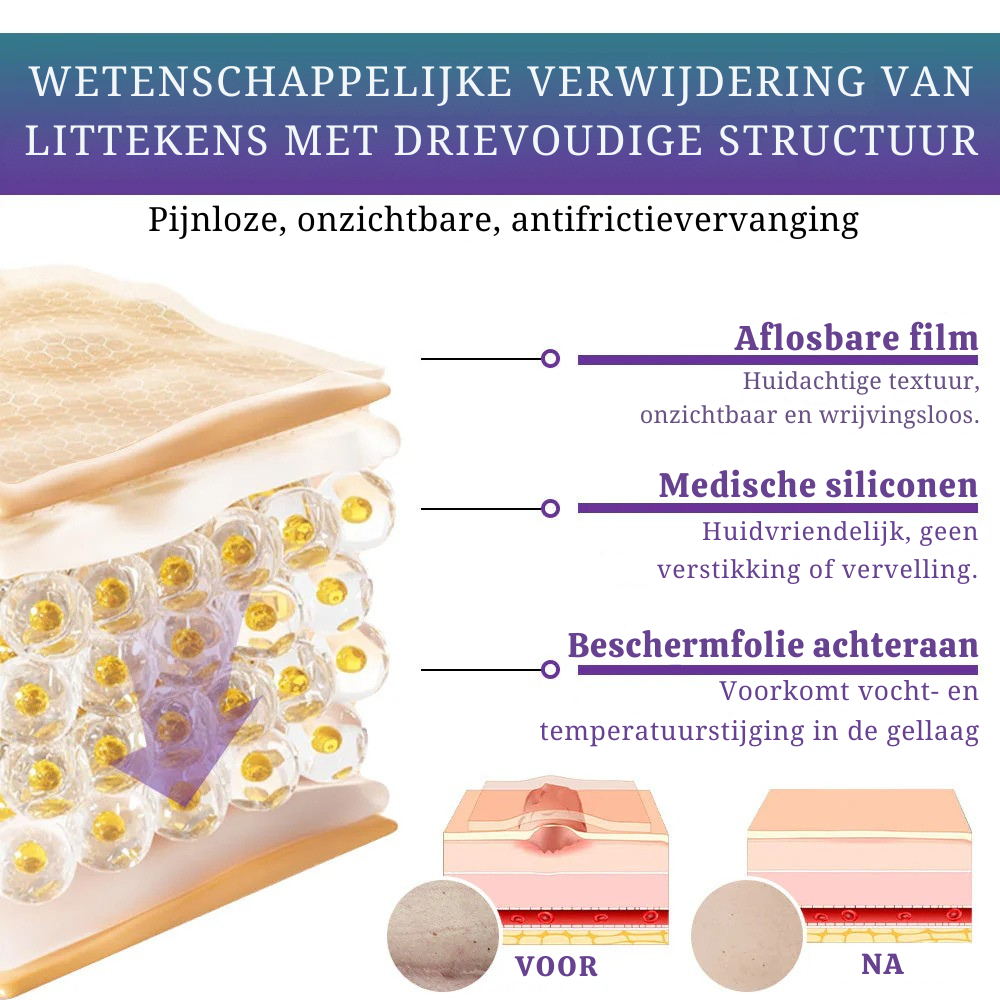 Vordela® 🏷️ ReGen Micronaald Tape met Nano-Hyaluronzuur 💊 Voor behandeling van littekens, striae, keloïden, acne, brandwonden en huidoneffenheden