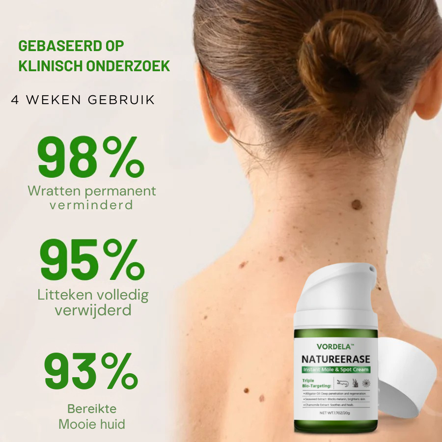 Officiële winkel: Vordela™ NatureErase Instant Mole & Spot Crème