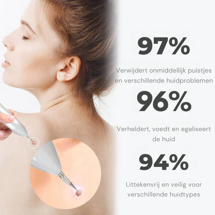 Vordela® Geavanceerde Plasma Laser Spot Schoonmaakpen