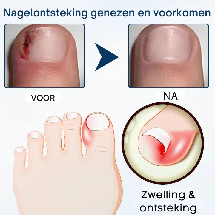 Vordela® OnyxiGuard Schimmelwerende Kruidenspray