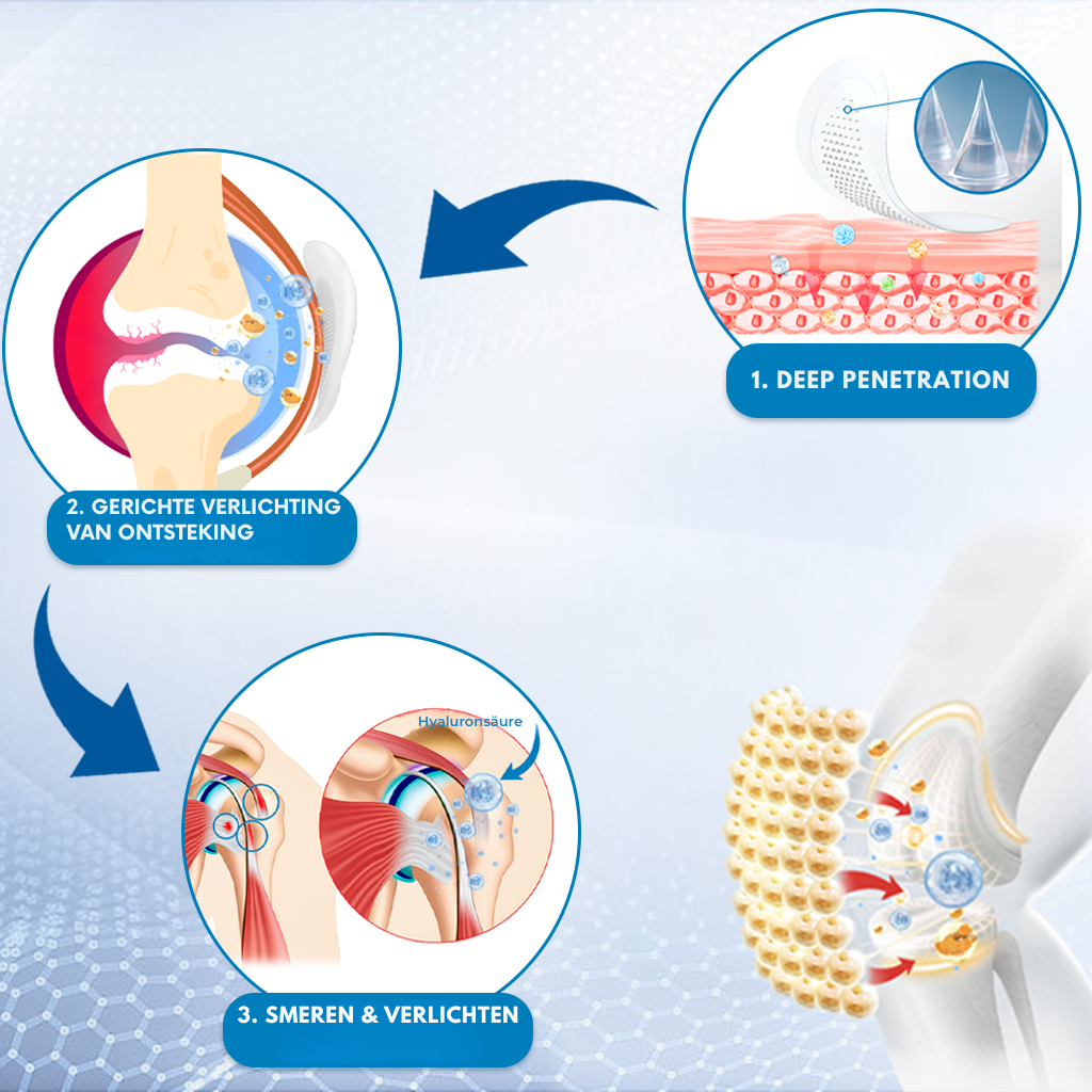 Vordela® Hyaluron Gewrichtsontlasting Microneedle Patches