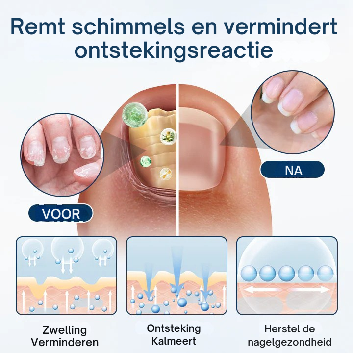 Vordela® OnyxiGuard Schimmelwerende Kruidenspray
