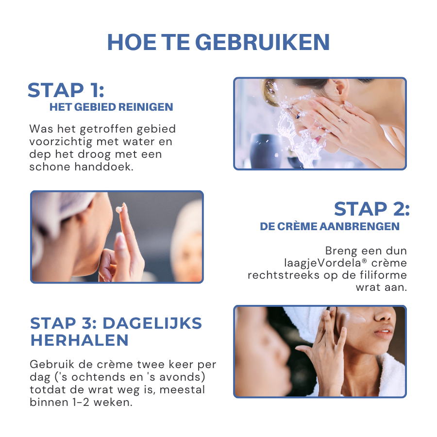 Vordela® HPV-filmvormige wratten verwijderingscrème
