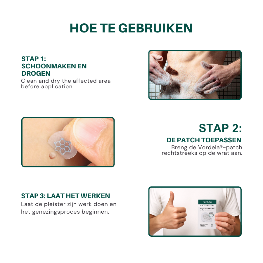 Vordela® Magnesium MicroPin HPV Genitale Wrat Verwijdering Patch