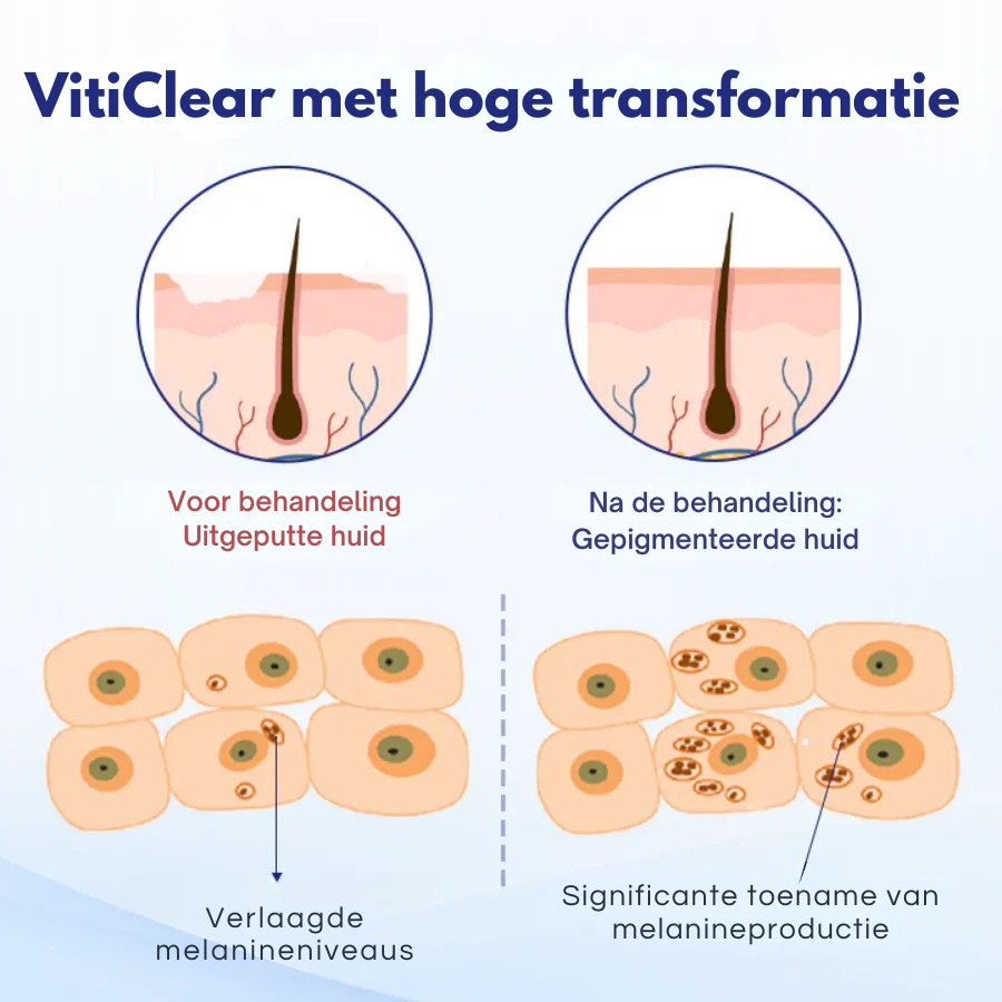 Vordela® VitiClear kruidenspray