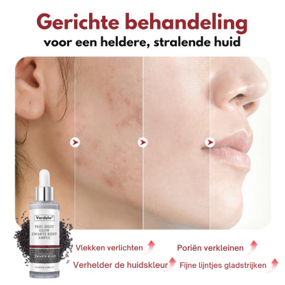 Vordela® Peel Shot Glow Zwarte Rijst Ampul