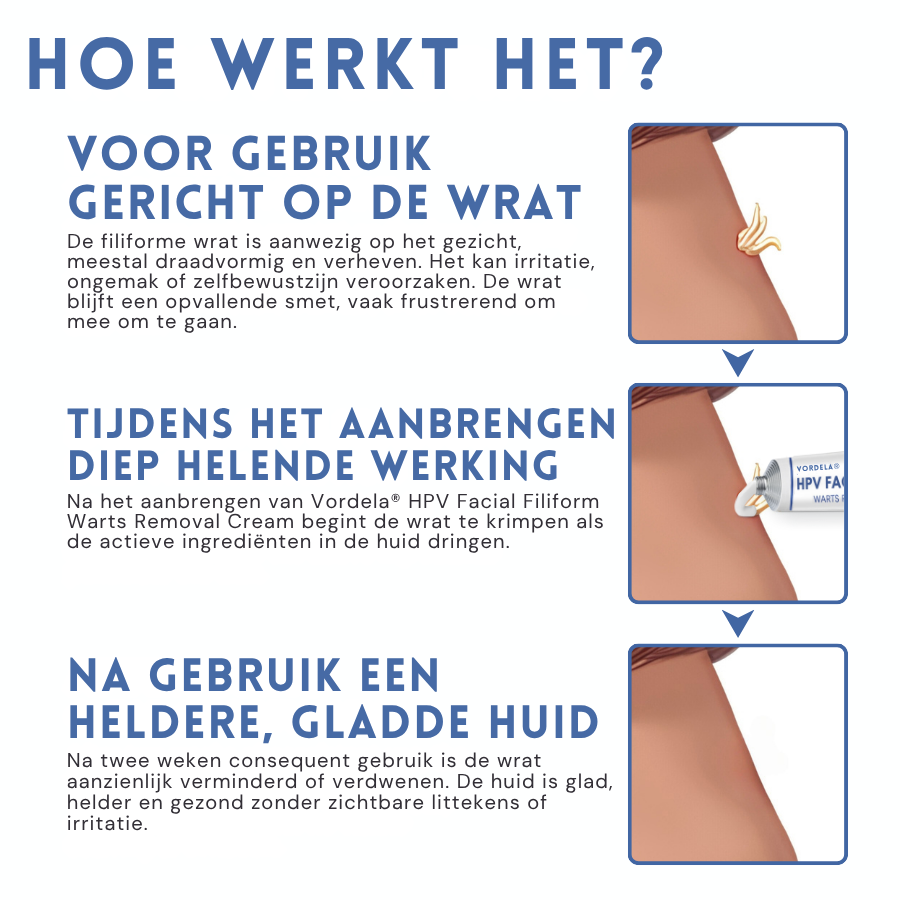 Vordela® HPV-filmvormige wratten verwijderingscrème