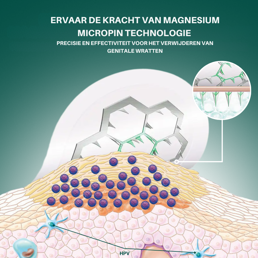 Vordela® Magnesium MicroPin HPV Genitale Wrat Verwijdering Patch