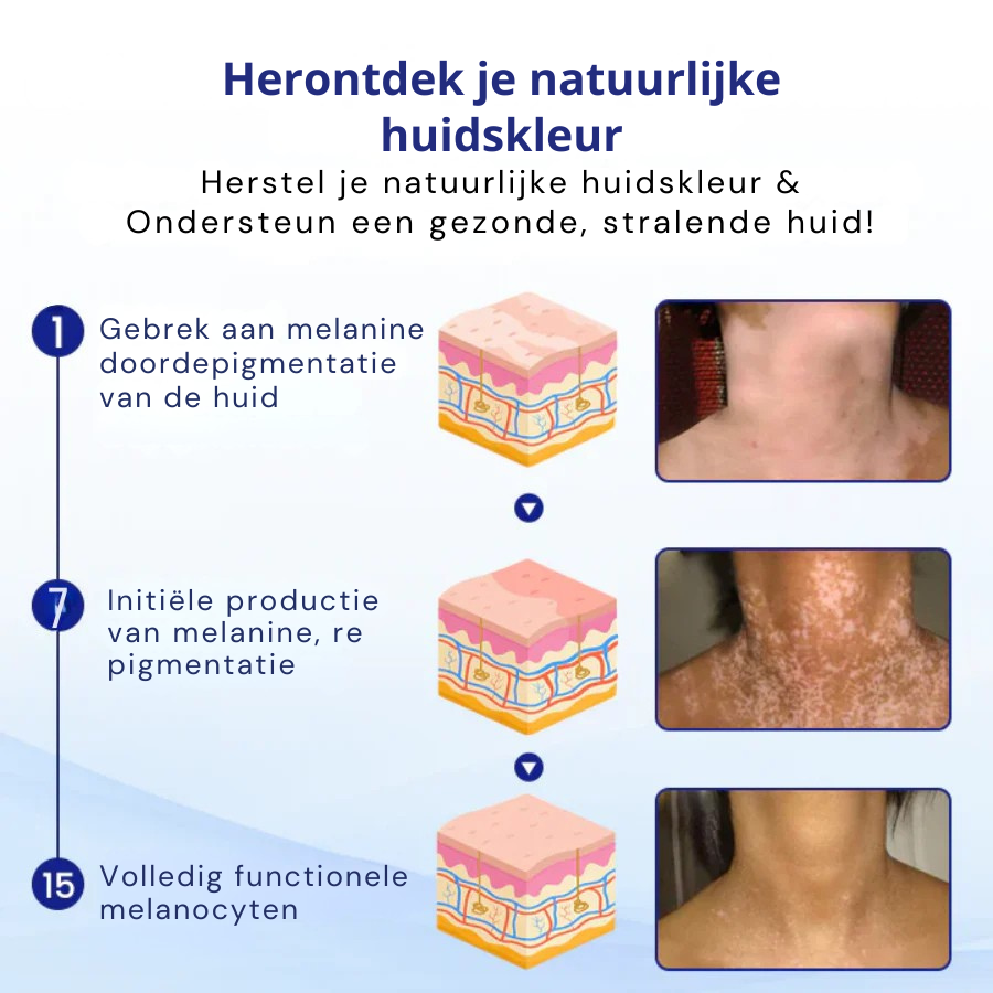 Vordela® VitiClear kruidenspray