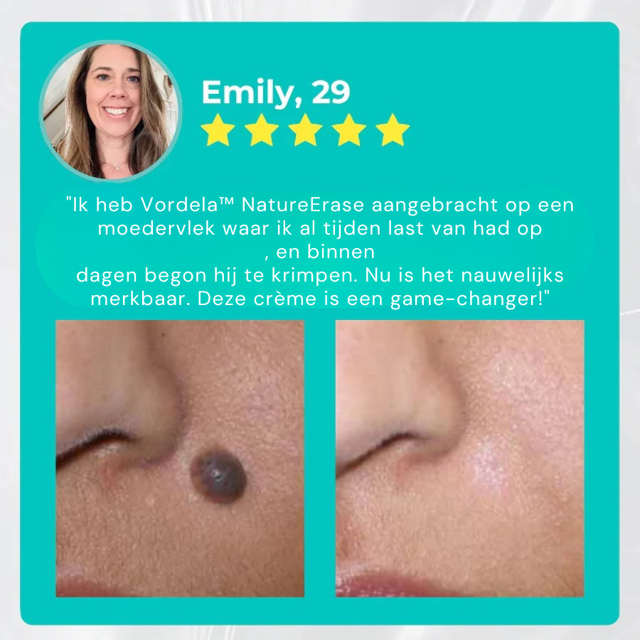 Officiële winkel: Vordela™ NatureErase Instant Mole & Spot Crème
