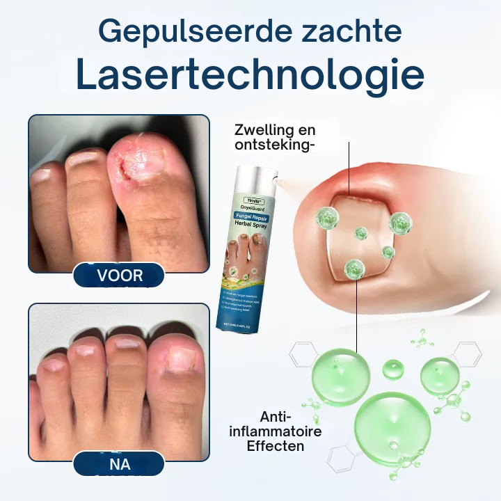 Vordela® OnyxiGuard Schimmelwerende Kruidenspray