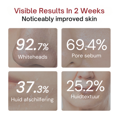 Vordela® Peel Shot Glow Zwarte Rijst Ampul