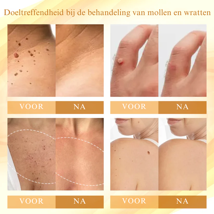 Vordela® Gecondenseerd Mellifera-gif Huidherstellende Crème