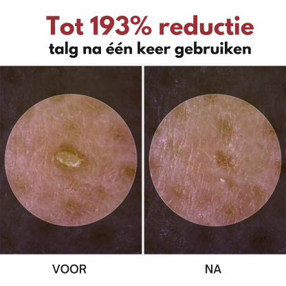 Vordela® Peel Shot Glow Zwarte Rijst Ampul
